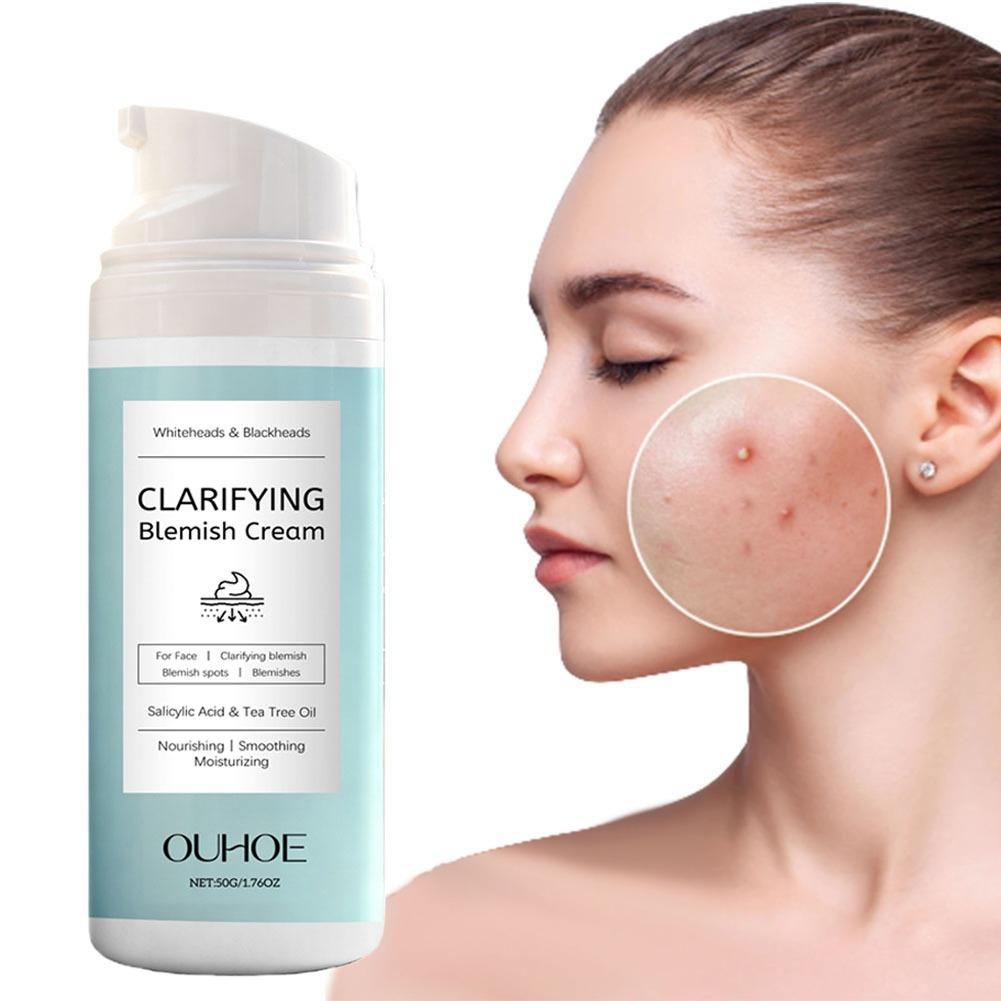 Salicylic Acid Blackhead Remover - 살리실산 여드름 제거 크림 영양 공급