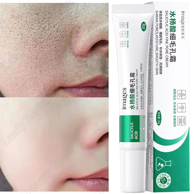 Salicylic Acid Blackhead Remover - 살리실산 모공 클리어링 크림 모공 축소