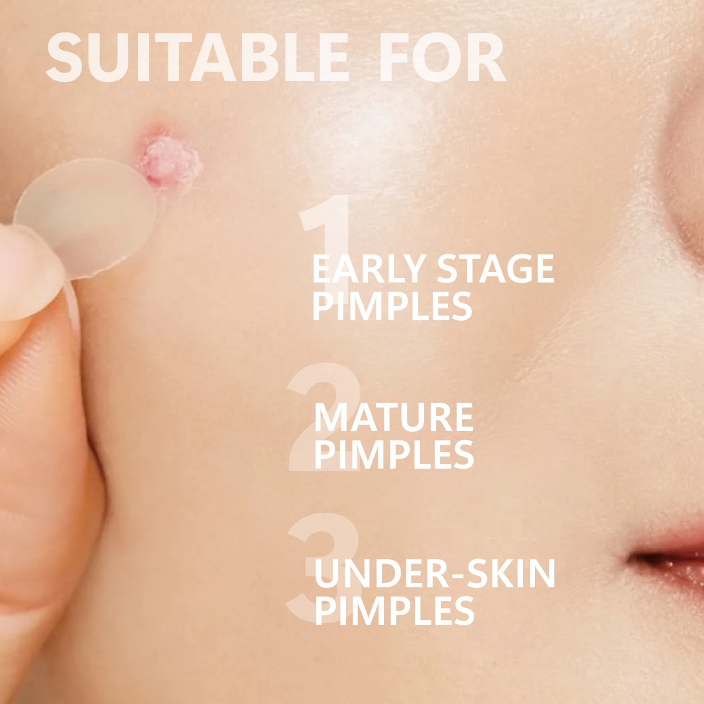 마이크로 니들 여드름 패치 (24팩) 하이드로콜로이드  - Hydrocolloid Pimple Patch 리뷰 및 가격