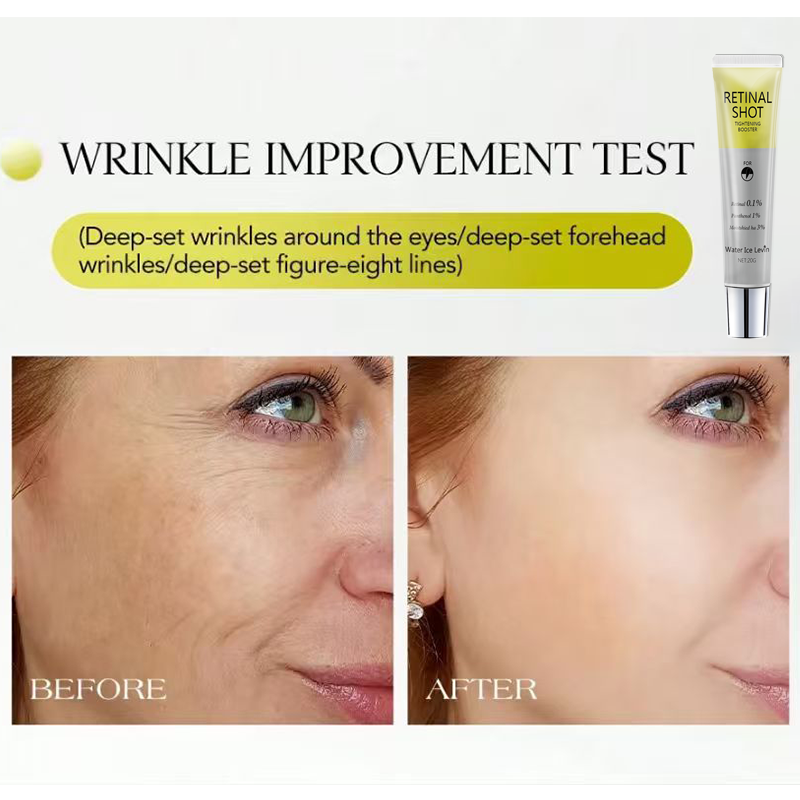 레티날 0.1% 고농축 에센스, 판테놀 1%, 히알루론 - Retinol Anti Wrinkle Cream 리뷰 및 가격