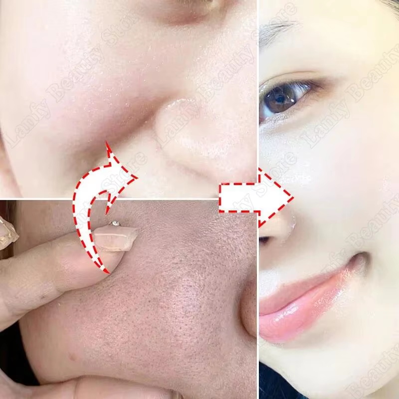살리실산 모공 클리어링 크림 모공 축소 블랙헤드 제거  - Salicylic Acid Blackhead Remover 리뷰 및 가격